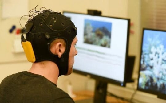 EEG(脳波計測)のイメージ写真
